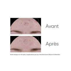 A-Derma Biology Ac Trattamento Opacizzante Anti-imperfezioni 40ml