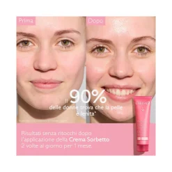 Caudalie Vinohydra Crema Sorbetto Idratante Viso 60ml