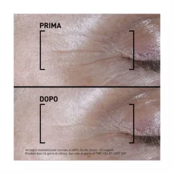 Filorga Time Filler Shot 5xp Siero Concentrato Linee Di Espressione 15ml