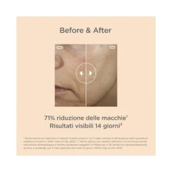 Isdinceutics Melaclear Siero Antimacchie 30ml
