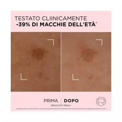 L'Oreal Paris Age Perfect Siero Correttore Anti Macchie 30ml
