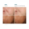 SkinCeuticals Phloretin CF Siero Antiossidante per Pelli Iperpigmentate con 10% di Vitamina C Pura 30ml