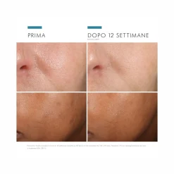 SkinCeuticals Phloretin CF Siero Antiossidante per Pelli Iperpigmentate con 10% di Vitamina C Pura 30ml