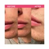Teaology Tea Glow Patch Idrocolloidali Anti-Imperfezioni 32 Pezzi