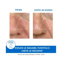 Uriage DS Emulsione 40ml