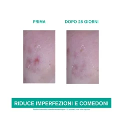 Uriage Hyseac 3 Regul+ Trattamento Globale Anti-imperfezioni 40ml