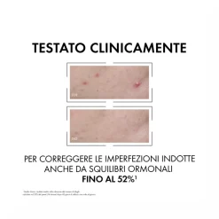 Vichy Normaderm Probio -Bha Siero Anti -Imperfezioni 30 ml