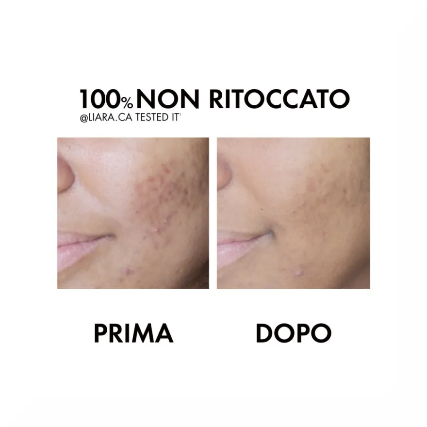 Vichy Normaderm Trattamento Idratante Doppia Azione 50ml